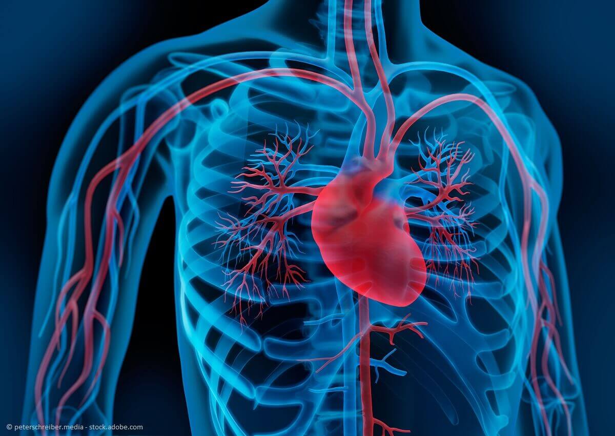 Volkskrankheit: Herz-Kreislauf-Erkrankungen